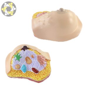 Modèle anatomique du <span class=keywords><strong>cancer</strong></span> du sein féminin dans la section transversale modèle de médecine du sein pathologique - Product Image 6