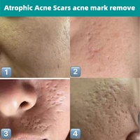 Kit de Soins Cutanés OEM Multi-Collagène et Élastine : Sérum en Poudre Lyophilisée pour le Traitement des Cicatrices d'Acné, Élimination des Marques et des Trous d'Acné