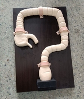 Simulateur de gros intestin Modèle d'entraînement à la coloscopie et à la sigmoïdoscopie avec caractéristiques de pathologie pour les sciences médicales