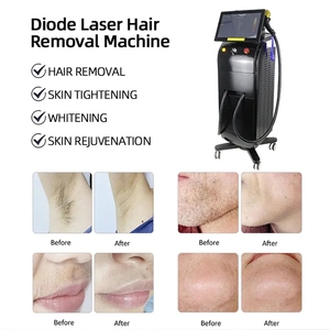 <span class=keywords><strong>Prix</strong></span> d'usine OEM ODM 1200W-2000W 755 808 1064nm Machine d'épilation au <span class=keywords><strong>laser</strong></span> à diode à triple longueur d'onde pour salon, clinique, spa - Product Image 3