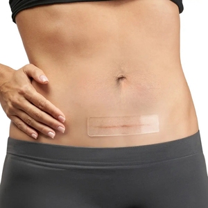 Cinta <span class=keywords><strong>de</strong></span> Silicona Transparente <span class=keywords><strong>de</strong></span> Grado Médico para <span class=keywords><strong>Cicatrices</strong></span>, Hipoalergénica, con Pegamento Acrílico, Cortable a Medida, Reutilizable, Impermeable y Ecológica - Product Image 5
