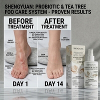 Spray Bio Fermenté à Base de Plantes pour Neutraliser les Odeurs des Pieds, Arbre à Thé et Eucalyptus, Brume Rafraîchissante pour les Pieds, Soin des Pieds Sans Cruauté Animale