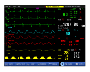 Monitor de Pacientes Multiparamétrico de 12.1 Pulgadas de Alta Calidad a Precio de Fábrica, Dispositivo Médico para Hospital, Monitor de Pacientes con ETCO2 - Product Image 6