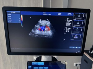 Kualitas tinggi jenis troli perangkat medis <span class=keywords><strong>128</strong></span> elemen pemeriksaan 19 tampilan LED warna <span class=keywords><strong>Ultrasound</strong></span> - Product Image 4