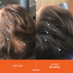 Champú para el crecimiento y engrosamiento del cabello con cafeína y biotina orgánica natural <span class=keywords><strong>de</strong></span> alto rendimiento para el crecimiento del cabello, champú espesante <span class=keywords><strong>de</strong></span> densidad - Product Image 2
