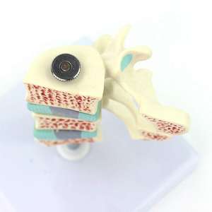 Gelsonlab HSBM-139 Tulang Belakang Model Anatomi, Model Osteoporosis, Ntervertebral Disc Model Perut Ortopedi Nyeri Model - Product Image 6