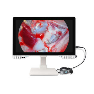 27 pulgadas 1080P Full HD 5 en 1 Endoscopio médico Cámara Sistema de artroscopio con artroscopia quirúrgica Laparoscopia Cistoscopio - Product Image 6