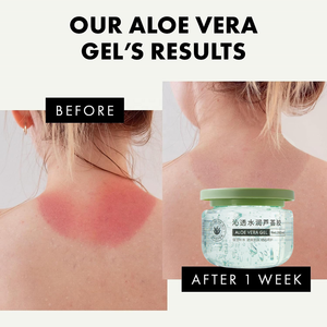 Crème <span class=keywords><strong>visage</strong></span> rafraîchissante à l'<span class=keywords><strong>aloe</strong></span> <span class=keywords><strong>vera</strong></span> TWG RTS, anti-acné, apaisante, gel <span class=keywords><strong>visage</strong></span> rafraîchissant, soin de la peau à l'<span class=keywords><strong>aloe</strong></span> <span class=keywords><strong>vera</strong></span> et à la centella, ensemble <span class=keywords><strong>pour</strong></span> le <span class=keywords><strong>visage</strong></span> et le corps - Product Image 6