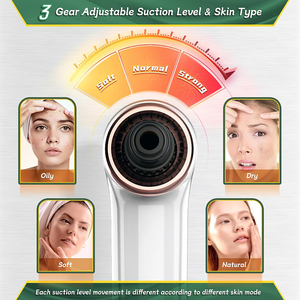 Removedor de espinillas, aspiradora eléctrica de limpieza Facial, aspiradora de poros, removedor de acné, limpiador Facial de espinillas, depurador de piel, aspiradora de cabeza negra - Product Image 5