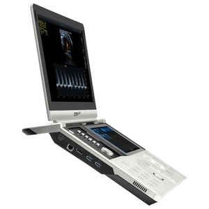 Ecógrafo Veterinario Portátil <span class=keywords><strong>VINNO</strong></span> D5 con Batería Recargable para Ecografía Animal, Examen Veterinario Móvil al Aire Libre, Diagnóstico Hospitalario - Product Image 3