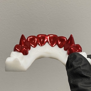 Grilles dentaires personnalisées en argent 925 plaqué or rouge, style hip-hop, vampire, pour hommes et femmes - Product Image 4