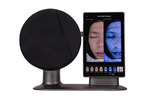 M17 AI 피부 및 두피 분석기 기계 피부 표시기, 오일 모낭 분석, 미용실 진단 장치 - Product Image 2