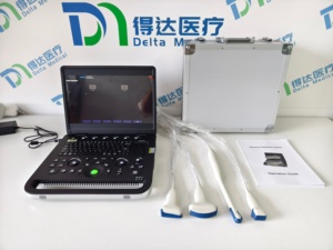 Ecógrafo Doppler Color Portátil DMU71 con Pantalla de 15.6 Pulgadas de Alta Resolución y Escáner 4D, Precio para Uso Humano y Veterinario - Product Image 4