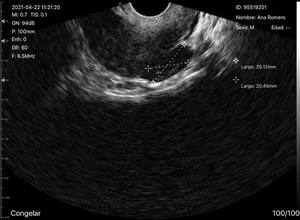 Draadloze Ultrasone Machine Handheld Sonde C10qt Dual-Sondes Multifunctionele Usb Echografie Convex + Endocavity + Cardiale Sonde - Product Image 6