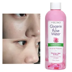 Marque privée Tonique à l'eau de rose à la glycérine pour le visage hydratant et nourrissant pour peau sensible hydratant et apaisant pour peau sèche bio