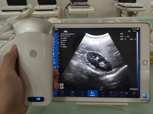 BESTRAN für Schweine Tragbarer Medizinischer Kabelloser Ultraschall-Konvexsonde mit Eingebauter Batterie aus Kunststoff 1 Jahr Garantie BT-UD82 - Product Image 4