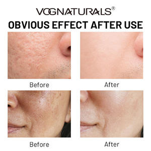 <span class=keywords><strong>La</strong></span> crème utilise <span class=keywords><strong>la</strong></span> température <span class=keywords><strong>pour</strong></span> resserrer les pores Crème raffinante <span class=keywords><strong>pour</strong></span> les pores Assez douce <span class=keywords><strong>pour</strong></span> <span class=keywords><strong>la</strong></span> peau quotidienne de <span class=keywords><strong>la</strong></span> <span class=keywords><strong>rosacée</strong></span> - Product Image 4