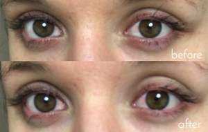 콜라겐 아이 패치 젤 속눈썹 패드 해적 의료 하이드로 하이드로 겔 마이크로 바늘 개인 라벨 뷰티 마스크 아이 패드 젤 패치 - Product Image 4