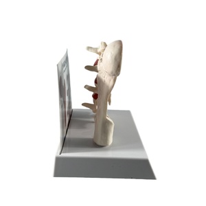 Modèle de pathologie de l'ostéoporose Modèle d'ostéoporose de vertèbre humaine Ensemble de modèles osseux ostéoporotiques - Product Image 5