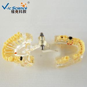 Modèle <span class=keywords><strong>dentaire</strong></span> scientifique médical avec dent manquante pour la formation dans les écoles et les hôpitaux - Vic Science - Product Image 5