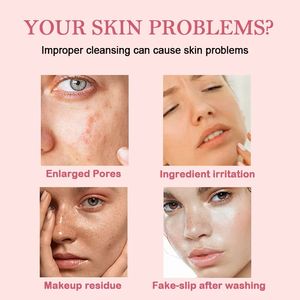 ครีมบำรุงผิว<span class=keywords><strong>หน้า</strong></span>มีกรดซาลิไซลิกควบคุมน้ำมันได้อย่างอ่อนโยนป้องกันการอักเสบและแบคทีเรีย - Product Image 5