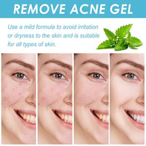 공장 뜨거운 판매 스킨 케어 살리실산 샐비어 수리 피부 미백 보습 페이셜 젤 - Product Image 3