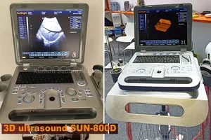 Penjualan laris peralatan USG sistem ultrasound 3D pemindai ultrasound portabel dokter hewan