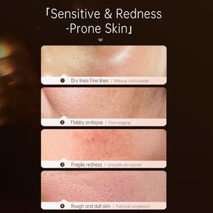 Olio Essenziale Viso alla Rosa Bulgara, Miscela Pura di Piante Infuse, Fragranza di Rosa Canina, Anti-Rughe, Rassodante, per Massaggio Facciale - Product Image 3