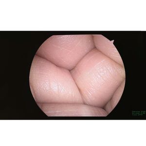 Full HD 1080P Y tế chẩn đoán thiết bị video Hệ thống <span class=keywords><strong>camera</strong></span> HD nội soi Hệ thống <span class=keywords><strong>camera</strong></span> nội soi - Product Image 4