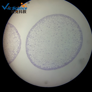Mitose des cellules animales (section d'œuf fécondé d'Ascaris lumbricoides) - Matériel pédagogique pour les collèges et les lycées - Product Image 2
