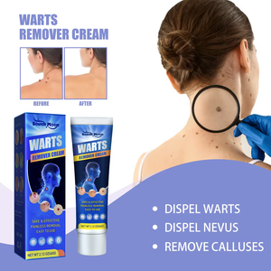 Crema OEM para el tratamiento de las verrugas, cuello, etiqueta para la piel, axila, verrugas planas, genitales, PIES, callos, crema, pomada para eliminar verrugas - Product Image 6