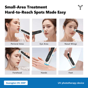 CN-308P1 308nm LED UVB Therapy Handheld Lithium Battery-Powered Easy Operation Mini Size for Vitiligo Psoriasis Treatment - Product Image 4
