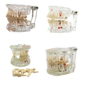 Tapón Dental 2x Grande, Cepillo de Dientes de Plástico/Niti/Acero Inoxidable, Eléctrico/Manual, Empaque Individual, Clase I para Enseñanza - Product Image 6