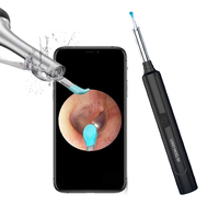Herramienta Inalámbrica para Remover Cera de Oídos con Certificación USB Ce, Cámara FHD 1080P, 6 Luces LED, Otoscopio, Limpiador de Oídos