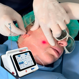 Endo Laser 1470nm 17W + 980nm 30W Liposuccion Machine USA Effacé CE Lipolyse Fiber Lifting Medical Device - Product Image 1