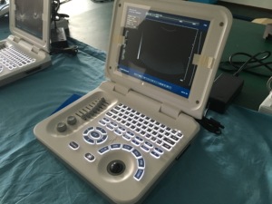 China <strong>Supplier</strong> Vet &amp; Human Use Pc Platform B/W Full Digital Ultra Sound <strong>Scan</strong> <strong>Ultrasound</strong> Machine - Product Image 2