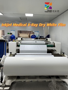 Services de films radiographiques secs médicaux compatibles avec les imprimantes jet d'encre haute vitesse – Fiables pour la radiographie numérique - Product Image 4