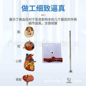 Modelo de hipertensión/presión arterial; Modelo de diabetes/visceras patológicas; Cerebro patológico; Presión ocular; Corazón; Riñones; - Product Image 3