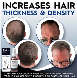 Produits de repousse des cheveux 2025, <span class=keywords><strong>anti</strong></span>-<span class=keywords><strong>chute</strong></span> de cheveux, FEG PLUS, spray de repousse des cheveux Feg - Product Image 2