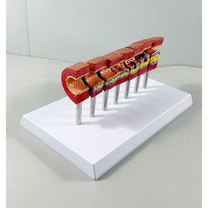 Modelo de Enseñanza de Anatomía Humana para Ciencias Médicas: Pie Diabético para Educación en Endocrinología y Patofisiología, Escuela de Medicina - Product Image 3