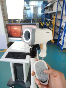 Hạt Nhân KN-2200 kỹ thuật số cầm tay video soi cổ tử cung di động kỹ thuật số âm đạo video soi cổ tử cung với phần mềm cho phụ khoa - Product Image 5