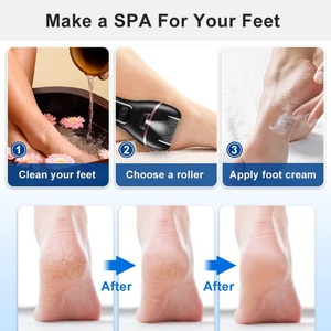 Offre Spéciale : Ponceuse Électrique Anti-Callosités pour les Pieds – Appareil de Pédicure et Outil de Soin des Pieds - Product Image 6