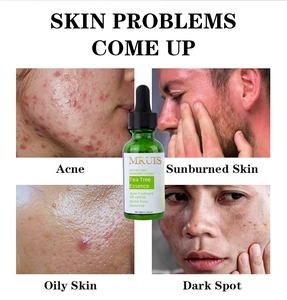 Suero de té verde orgánico Mruis, suero antiacné, tratamiento de espinillas, suero de control de Aceite hidratante antioxidante brillante - Product Image 2