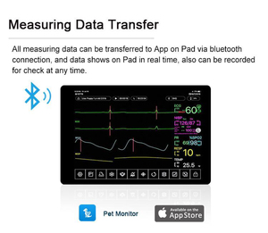 Moniteur <span class=keywords><strong>Holter</strong></span> vétérinaire personnalisé de haute qualité pour la fréquence <span class=keywords><strong>cardiaque</strong></span>, la respiration et la température – <span class=keywords><strong>Prix</strong></span> compétitif - Product Image 5