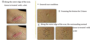 Appareil de raffermissement portable à plasma d'or pour le visage et le corps, élimination des cicatrices, taches et rides, usage domestique et spa, 6 embouts - Product Image 6