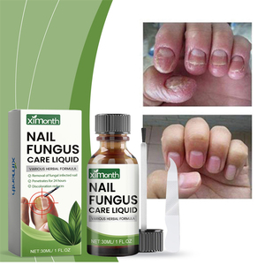 Ximonth 30ml Liquide de Soin des Ongles Contre les Mycoses avec Lime – Réduit l'Inconfort des Ongles des Pieds, Restaure la Santé et Nourrit les Ongles - Product Image 1