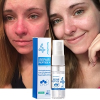 Soin réparateur extra fort apaisant pour peaux sensibles abîmées par les stéroïdes, à base d'ADN de saumon fermenté, PDRN, Oligopeptide-1, Oligopeptide-3, en spray 4A