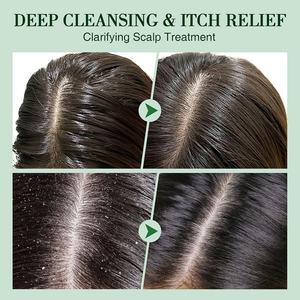 Pegatinas Personalizadas, Exfoliante Capilar Orgánico de Aceite de Árbol de Té y Menta, Bajo MOQ, Sal del Himalaya para Purificar el Cuero Cabelludo y Fortalecer el Cabello - Product Image 6