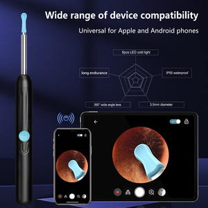 กล้องส่องหูเด็กแบบ HD เชื่อมต่อ <span class=keywords><strong>WIFI</strong></span> โดยตรง พร้อมอุปกรณ์แคะหูอัจฉริยะ - Product Image 2