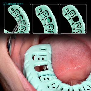 Plateaux d'empreinte dentaire pour implants, supports de dents en plastique, déflecteurs pliables en plastique, tailles S/M/<span class=keywords><strong>L</strong></span>, pour implantation dentaire - Product Image 5